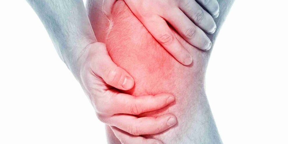 Nyeri pada lutut bengkok atau lurus adalah gejala arthrosis sendi lutut