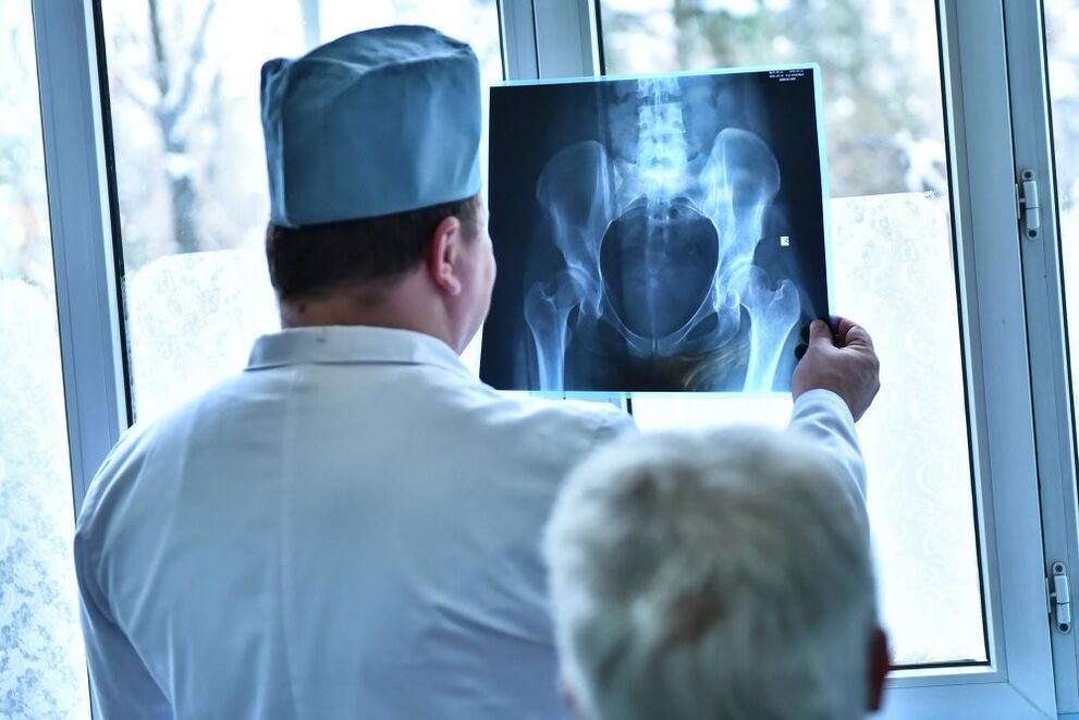 Dokter melihat gambar sendi panggul yang menderita arthrosis