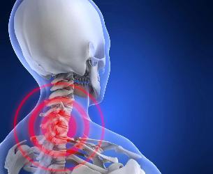 Lokasi rasa sakit di leher rahim osteochondrosis